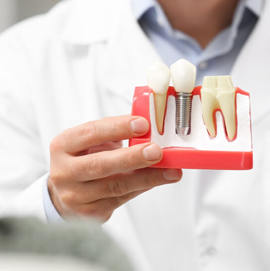 All-on-4® Dental Implants In Colts Neck, NJ