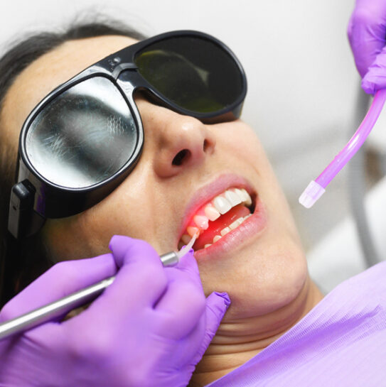 Anesthesia-Free Fillings with State of the Art Laser Dentistry in Colts Neck, NJ
